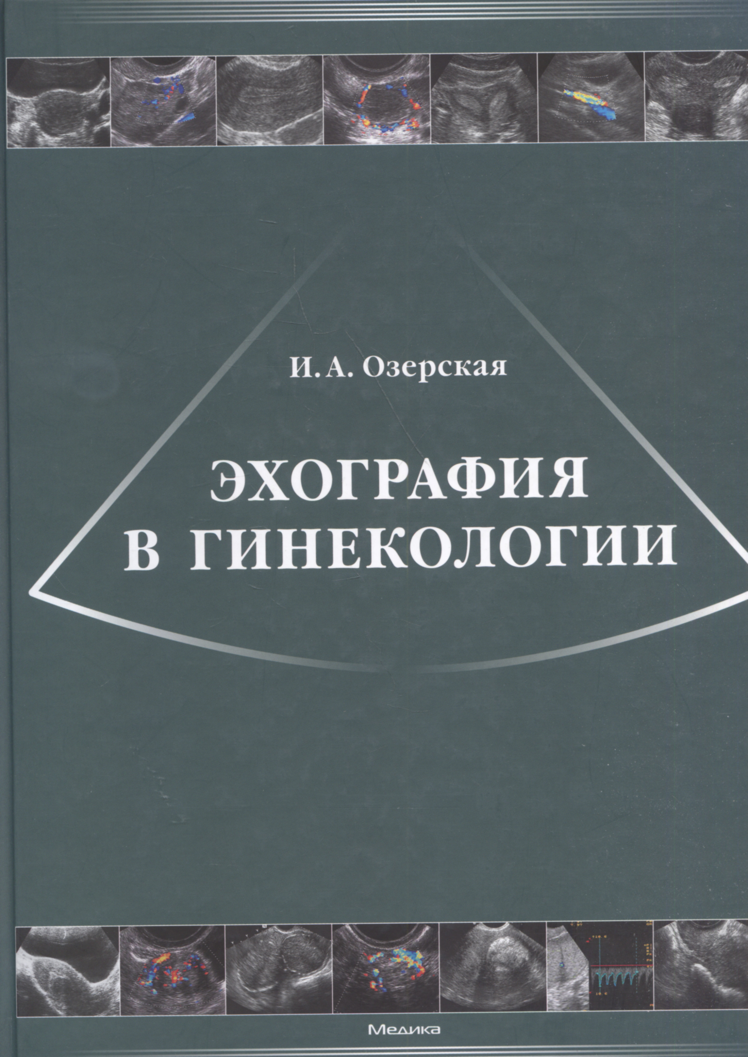 Эхография в гинекологии