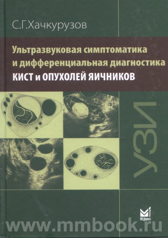 Ультразвуковая симптоматика и дифференциальная диагностика кист и опухолей яичников