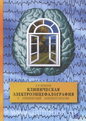 Клиническая электроэнцефалография с элементами эпилептологии руководство для врачей зенков