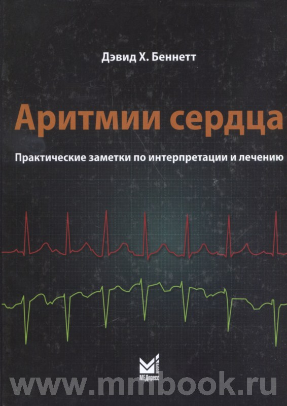 Аритмии сердца