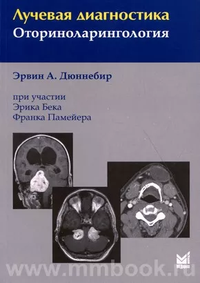 Лучевая Диагностика. Оториноларингология, Дюннебир Э.А., 978-5.