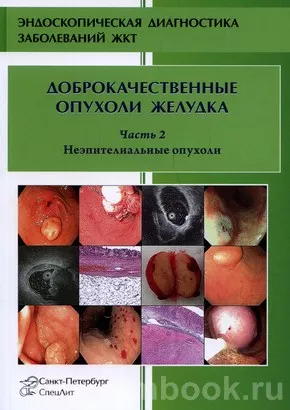 Доброкачественные опухоли влагалища: симптомы, причины, лечение и диагноститка