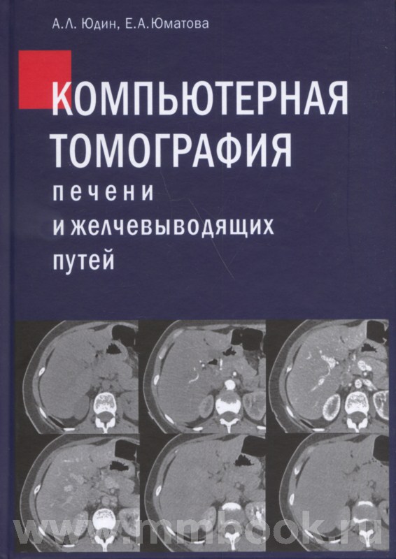 Компьютерная томография печени и желчевыводящих путей: практическое руководство