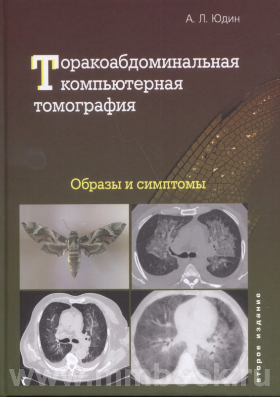 Торакоабдоминальная компьютерная томография. Образы и симптомы