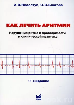 Как лечить аритмии. Нарушение ритма и проводимости в клинической практике