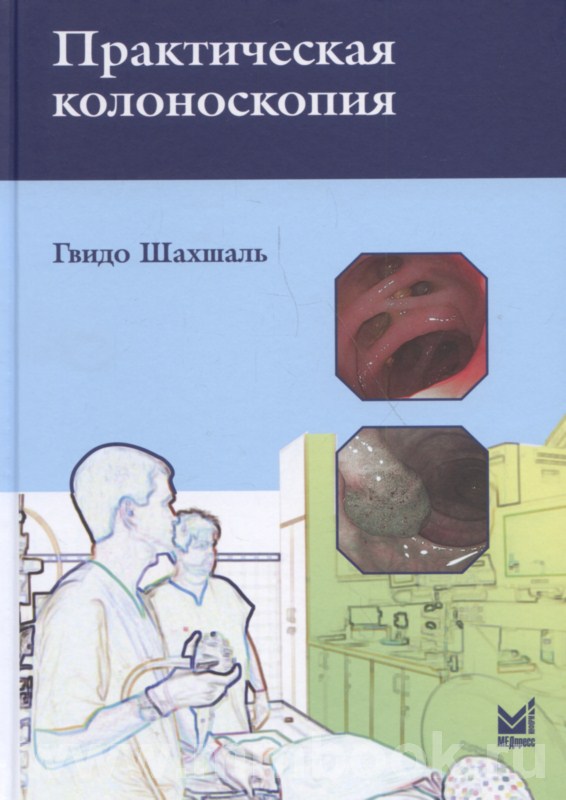 Практическая колоноскопия. Методика, рекомендации, советы и приемы