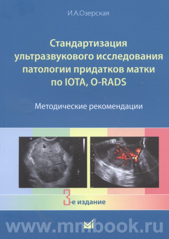 Стандартизация ультразвукового исследования патологии придатков матки по IOTA, O-RADS