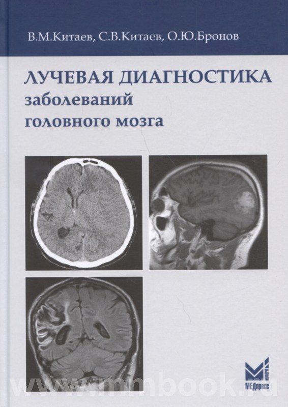 Лучевая диагностика заболеваний головного мозга