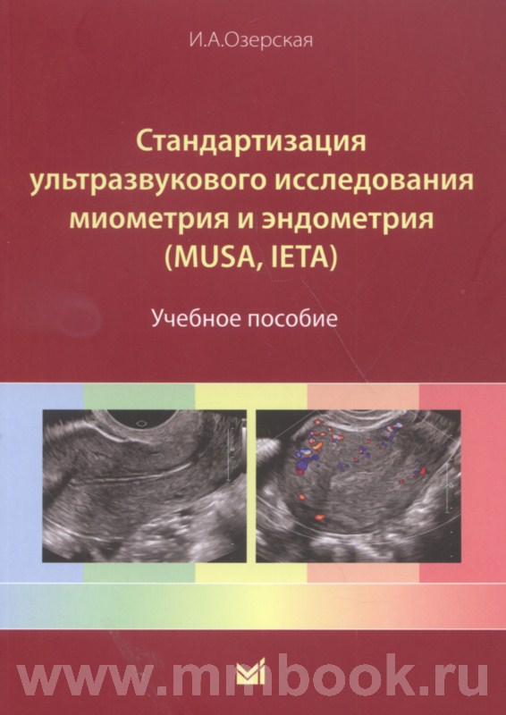 Стандартизация ультразвукового исследования миометрия и эндометрия (MUSA, IETA)