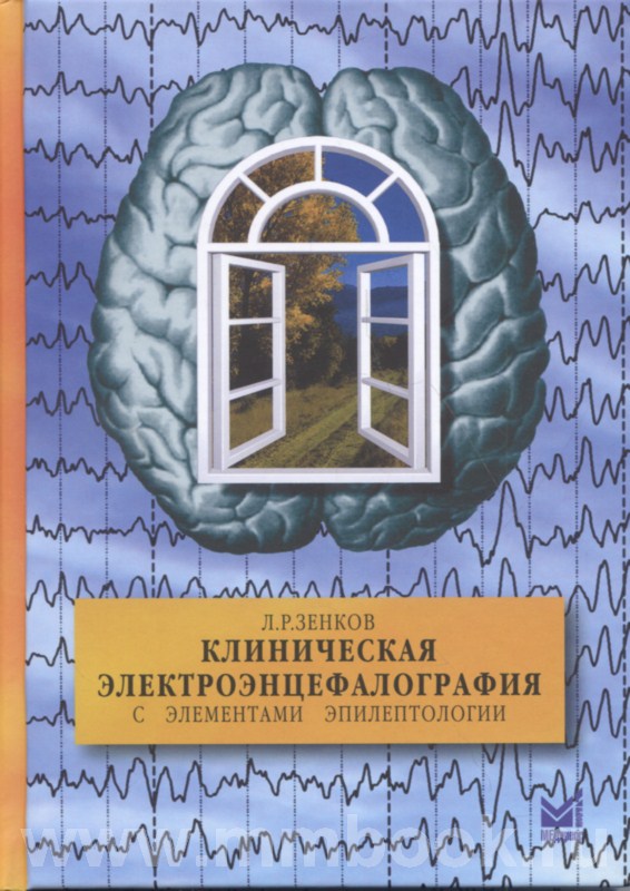 Клиническая электроэнцефалография (с элементами эпилептологии). Руководство для врачей 