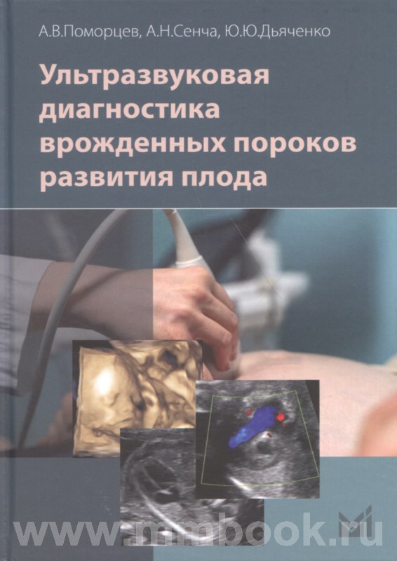Ультразвуковая диагностика врожденных пороков развития плода