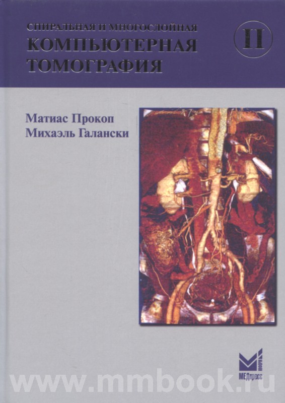 Спиральная и многослойная компьютерная томография. Том 2