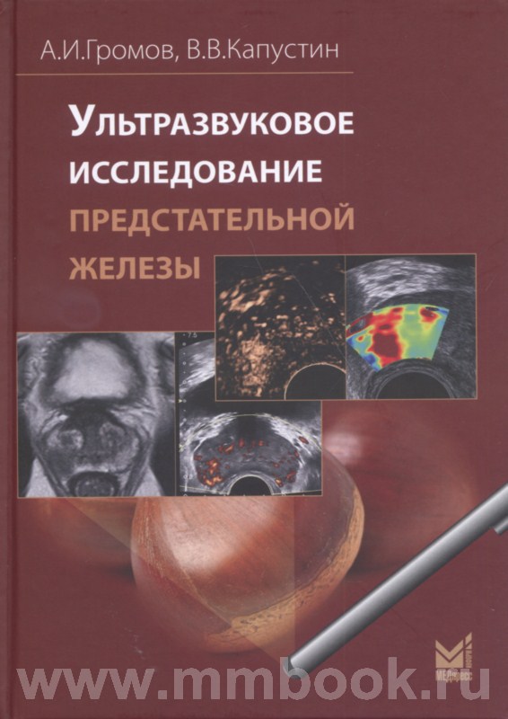 Ультразвуковое исследование предстательной железы