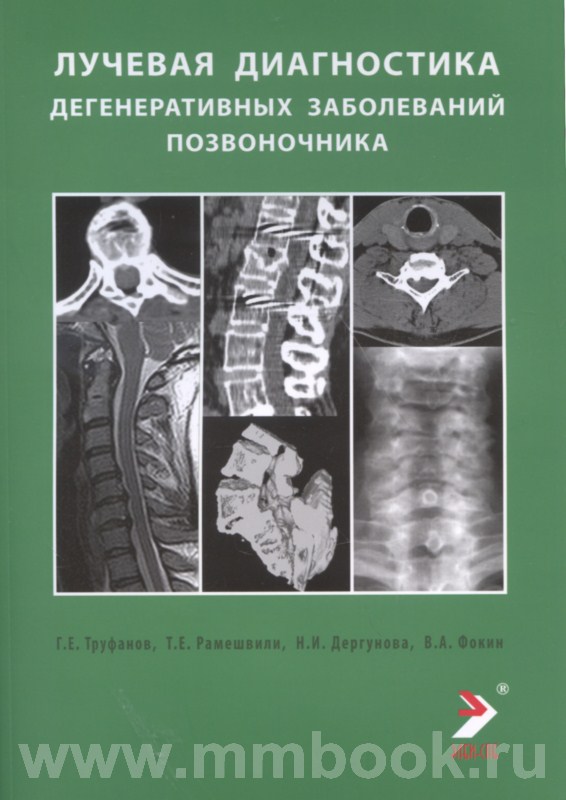 Лучевая диагностика дегенеративных заболеваний позвоночника