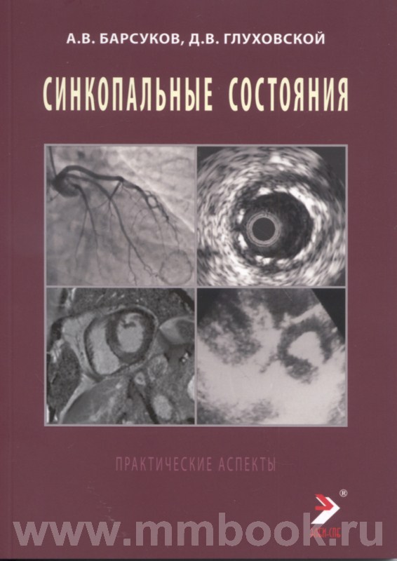 Синкопальные состояния: практические аспекты