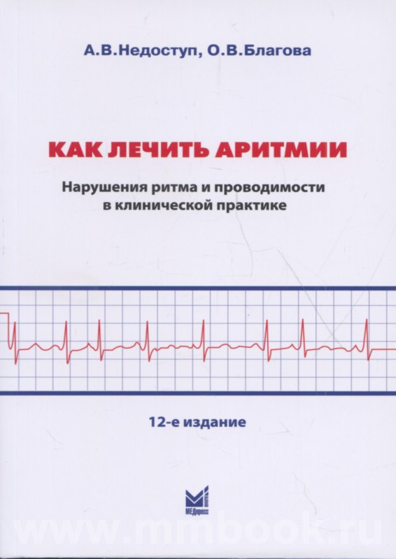 Как лечить аритмии. Нарушения ритма и проводимости в клинической
