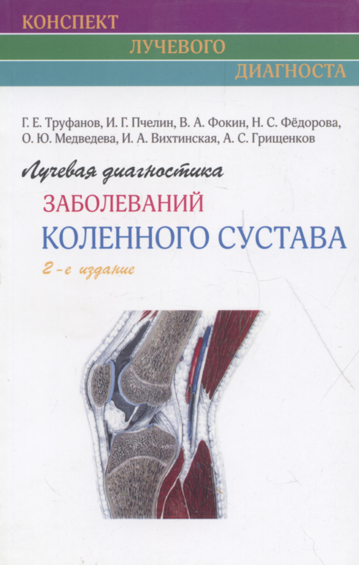 Лучевая диагностика заболеваний коленного сустава