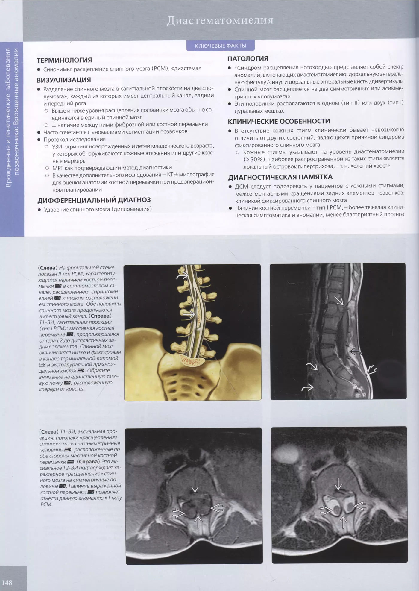 Spina bifida у детей – лечение патологии и особенности заболевания