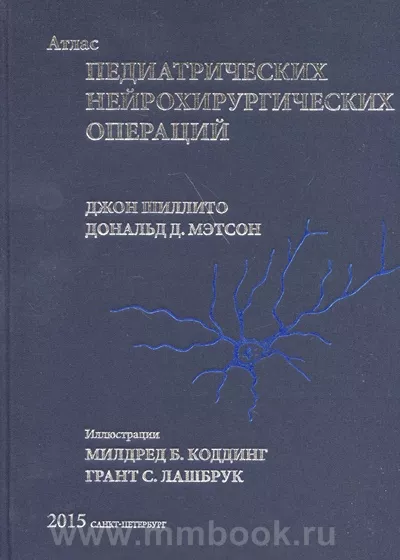 Что такое молочница и бактериальный вагиноз и как этого избежать