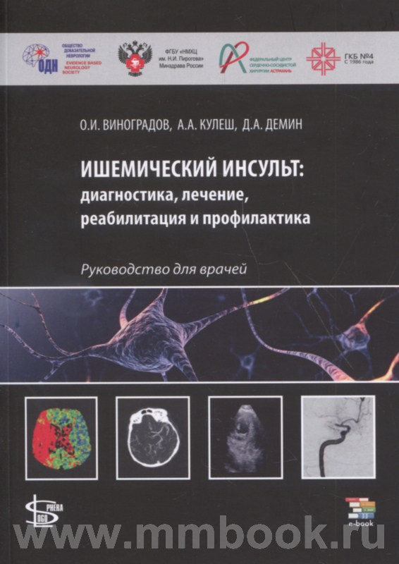 Ишемический инсульт: диагностика, лечение