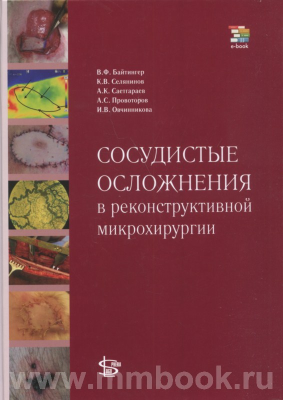 Сосудистые осложнения в реконструктивной микрохирургии