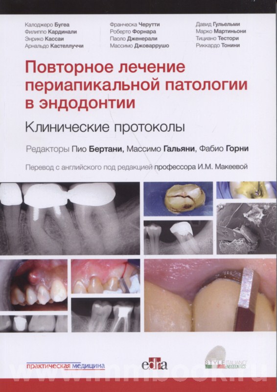 Повторное лечение периапикальной патологии в эндодонтии. Клинические протоколы