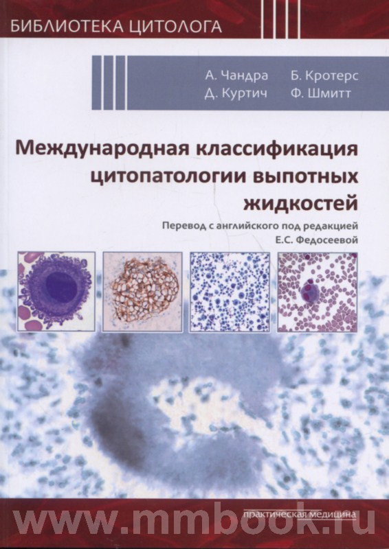 Международная классификация цитопатологии выпотных жидкостей