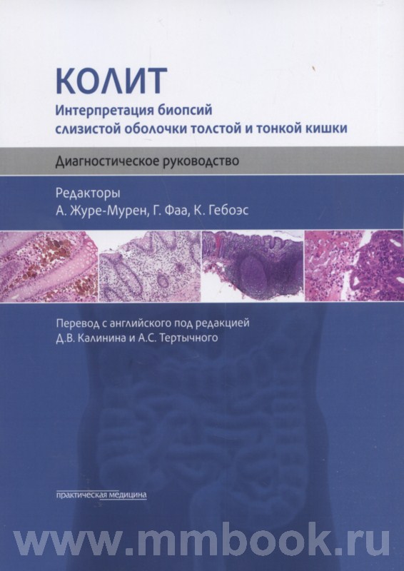 Колит. Интерпретация биопсий слизистой оболочки толстой и тонкой кишки. Диагностическое руководство