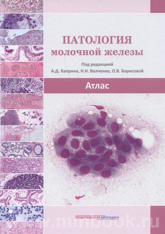 Патология молочной железы. Атлас