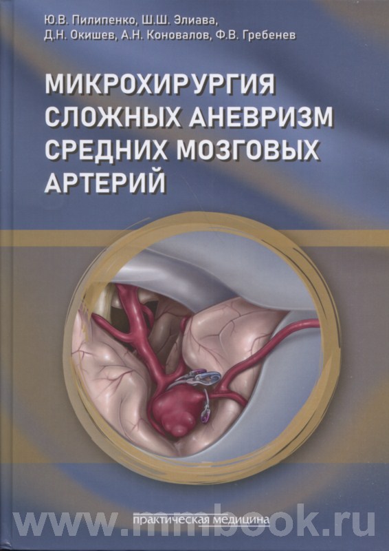 Микрохирургия сложных аневризм средних мозговых артерий
