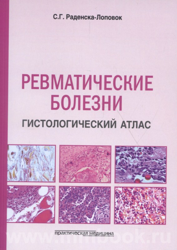 Ревматические болезни. Гистологический атлас