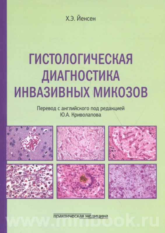 Гистологическая диагностика инвазивных микозов