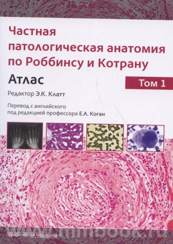 Частная патологическая анатомия по Роббинсу и Котрану. Атлас в двух томах