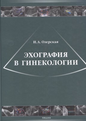 Эхография в гинекологии