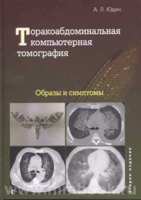 Торакоабдоминальная компьютерная томография. Образы и симптомы