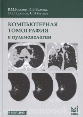 Компьютерная томография в пульмонологии