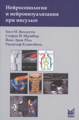 Нейросонология и нейровизуализация при инсульте