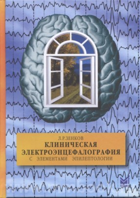 Клиническая электроэнцефалография (с элементами эпилептологии). Руководство для врачей
