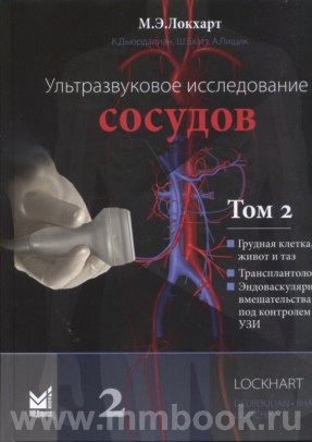 Ультразвуковое исследование сосудов. Том 2