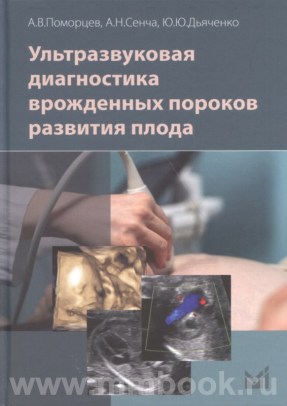 Ультразвуковая диагностика врожденных пороков развития плода