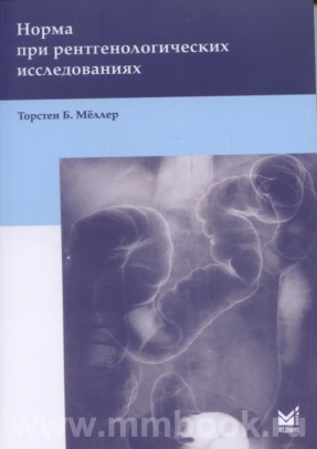 Норма при рентгенологических исследованиях