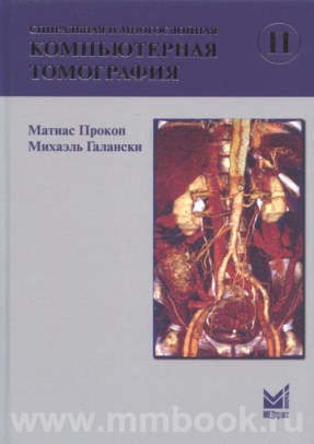 Спиральная и многослойная компьютерная томография. Том 2