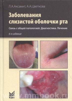 Заболевания слизистой оболочки рта. Связь с общей патологией. Диагностика. Лечение