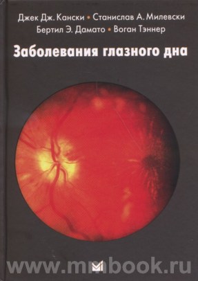 Заболевания глазного дна