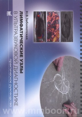 Лимфатические узлы в ультразвуковой диагностике