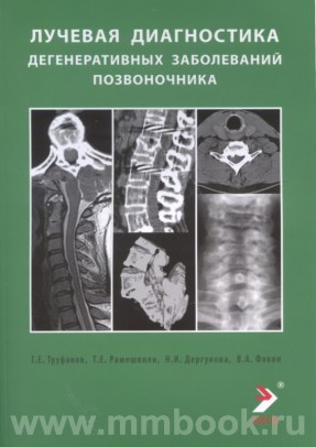 Лучевая диагностика дегенеративных заболеваний позвоночника