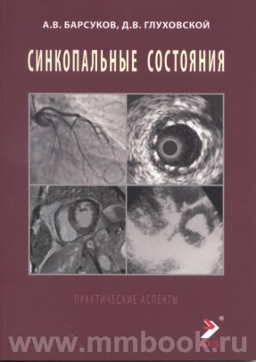 Синкопальные состояния: практические аспекты