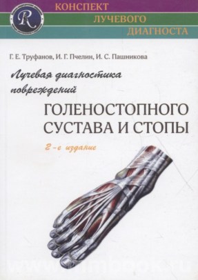 Лучевая диагностика повреждений голеностопного сустава и стопы