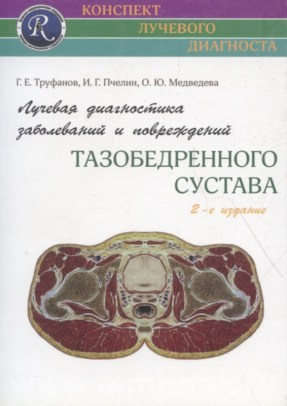 Лучевая диагностика заболеваний и повреждений тазобедренного сустава