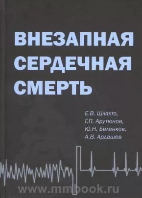 Внезапная сердечная смерть